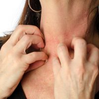 Itchy skin during menopause