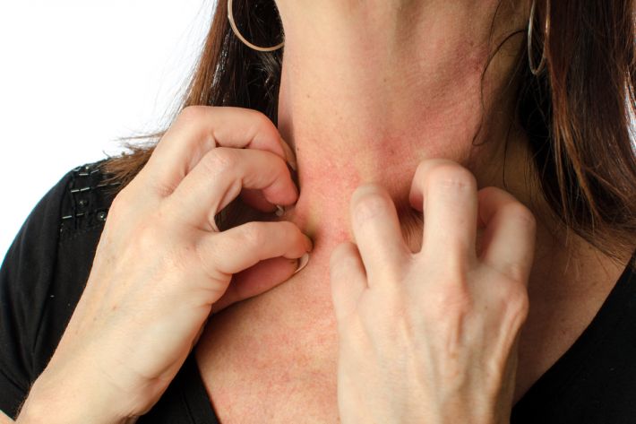 Itchy skin during menopause