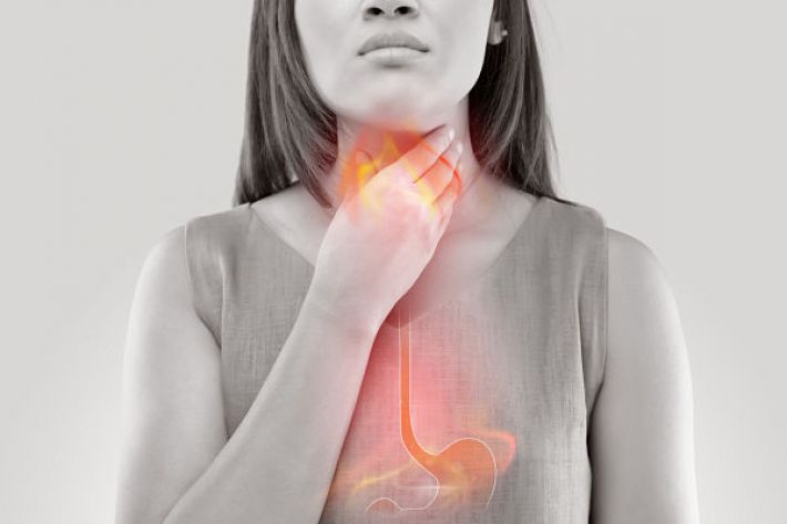 is it heartburn or reflux?