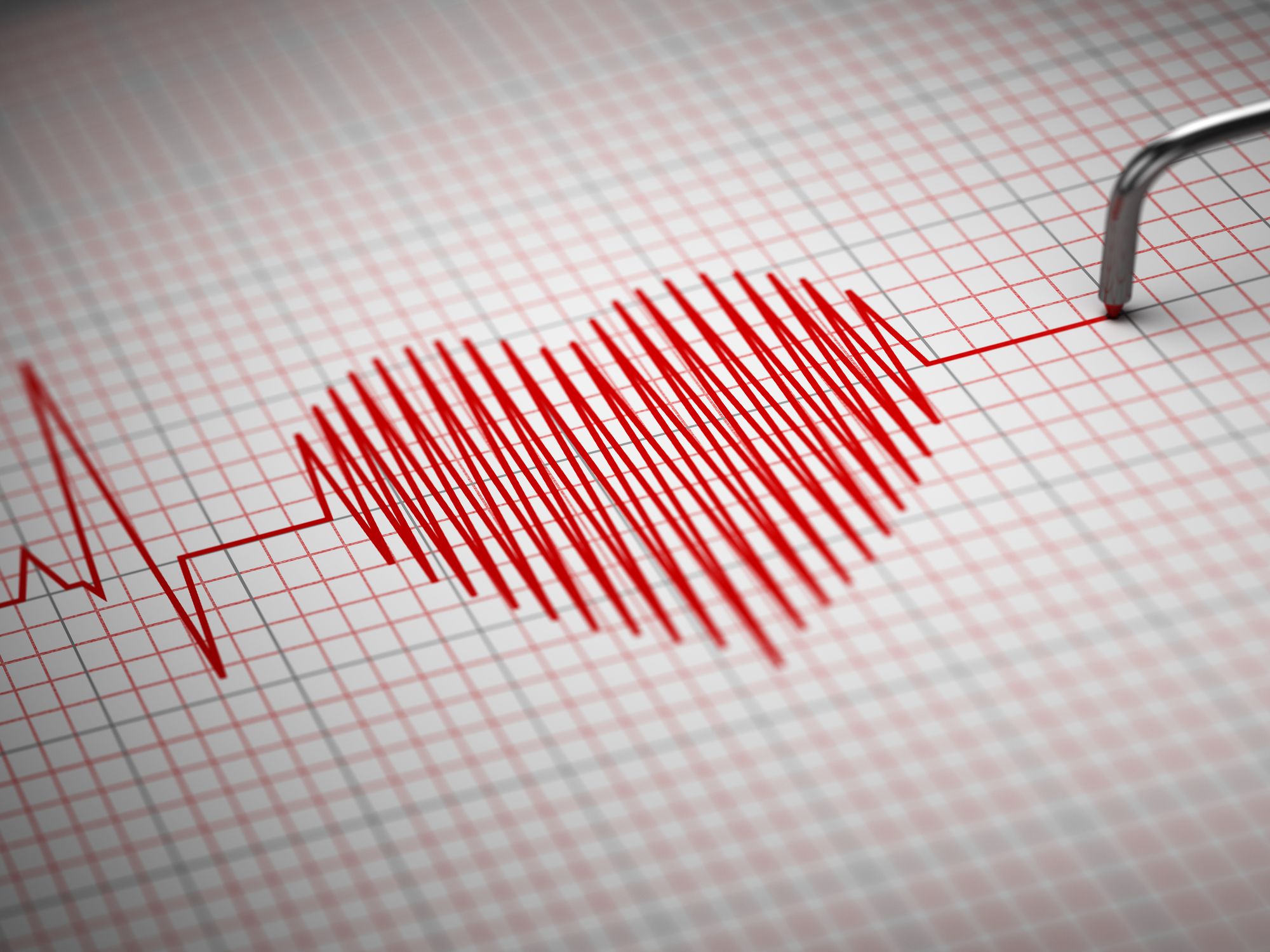 Palpitations and Menopause