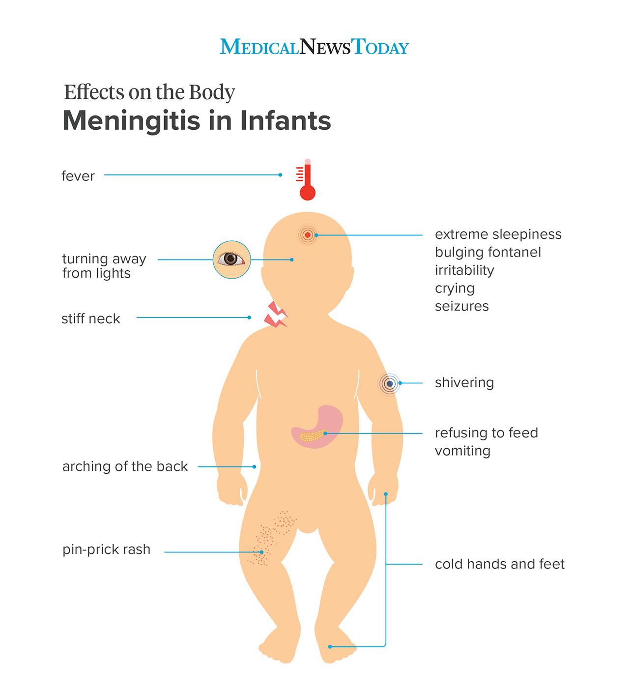 Meningitis in children