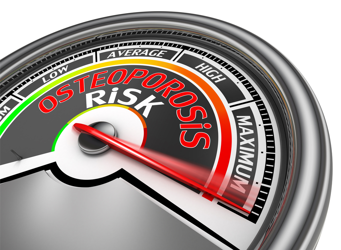 The risks factors of Osteoporosis on World Osteoporosis Day