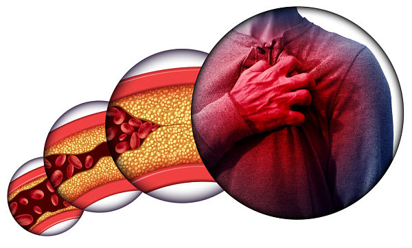 How to lower your cholesterol levels